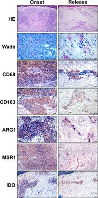 Potential Role of CXCL10 in Monitoring Response to Treatment in Leprosy Patients